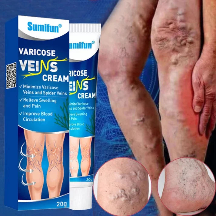 2 PCS Sumifun®Varicose Vein Cream✅ 7-Day Improvement Guarantee – Full Refund if No Results