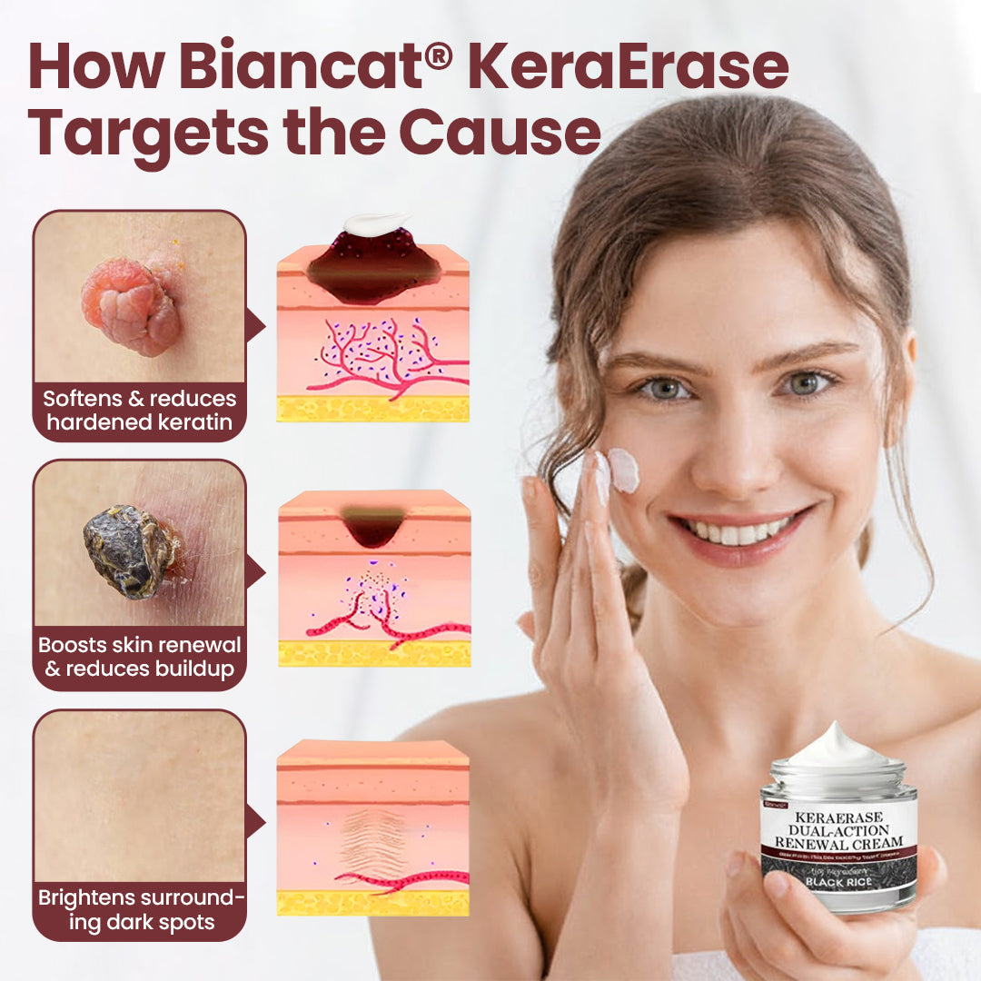 Biancat®KeraErase Dual-Action Renewal Cream✅ 7-Day Improvement Guarantee – Full Refund if No Results