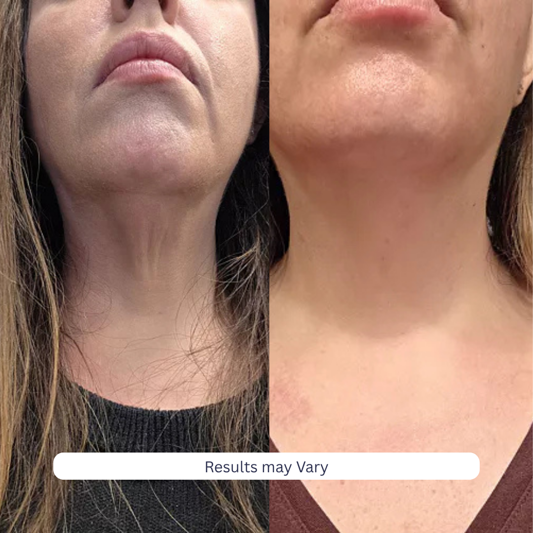 Tighten & Lift Neck Cream