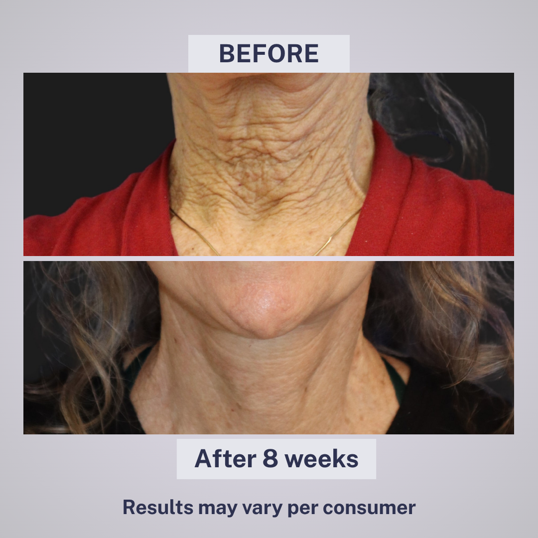 Tighten & Lift Neck Cream