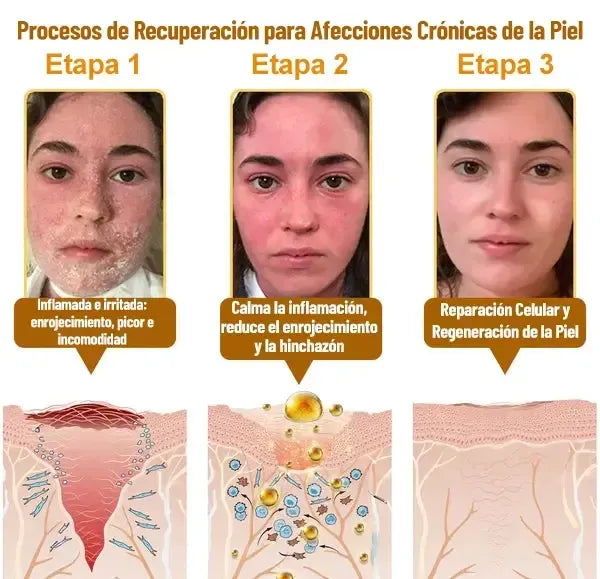 El Descubrimiento Natural “Prohibido” Que Borra Años de Daño en la Piel y Acaba con la Lucha Diaria contra la Psoriasis, las Arrugas y Problemas Crónicos de la Piel