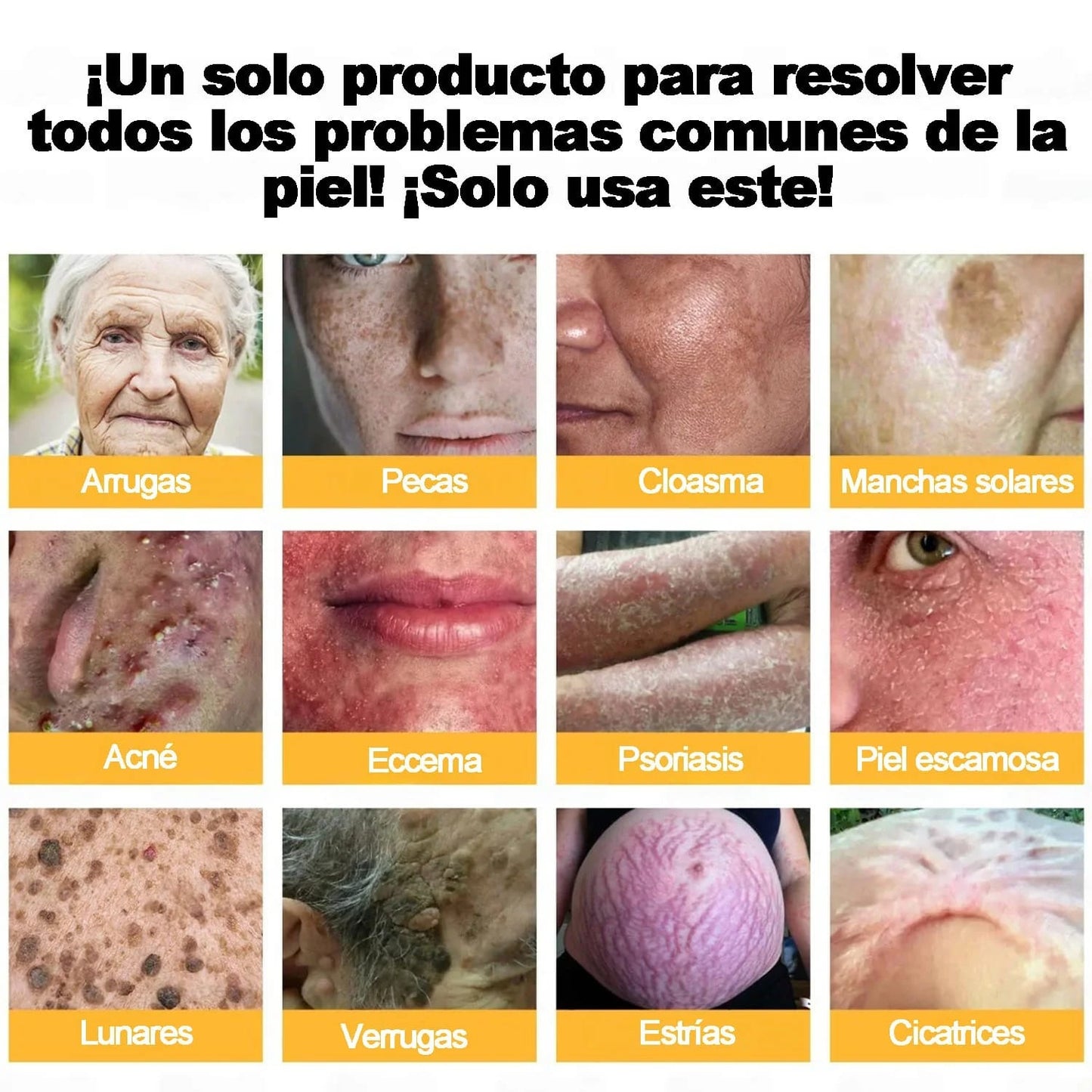 El Descubrimiento Natural “Prohibido” Que Borra Años de Daño en la Piel y Acaba con la Lucha Diaria contra la Psoriasis, las Arrugas y Problemas Crónicos de la Piel