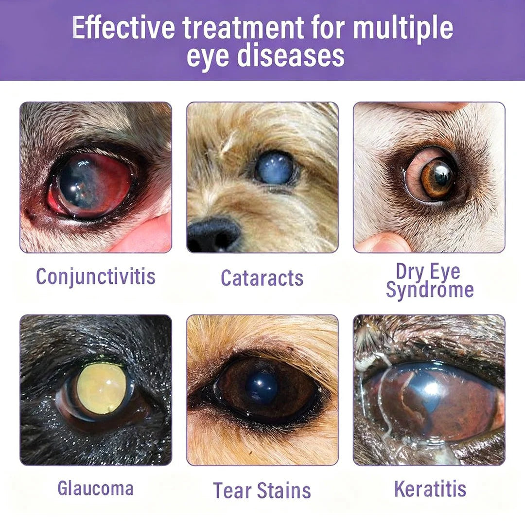 Relieves Conjunctivitis, Dry Eyes, Cataracts, and Keratitis